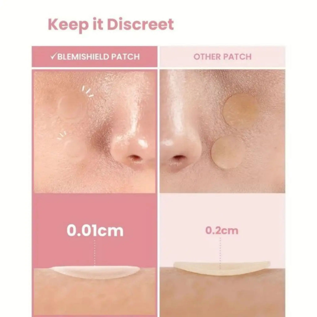 Acne Patches Hydrocolloid 38pcs | Invisible & Fast Healing | Siempre Bellas